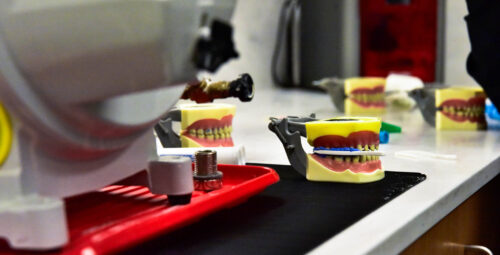 Four replicate models of human jaws are on a white table. Inside one of the replicas is a blue dental mold.